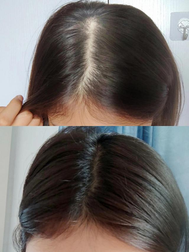 头发怎么养回来，头发要怎么养回来