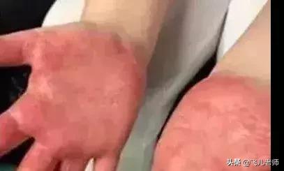 橡皮泥玩具是否有毒，孩子玩的水晶泥竟然有毒