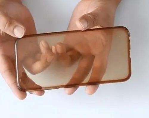 手机壳发黄怎么办最简单方法，手机壳发黄别着急丢