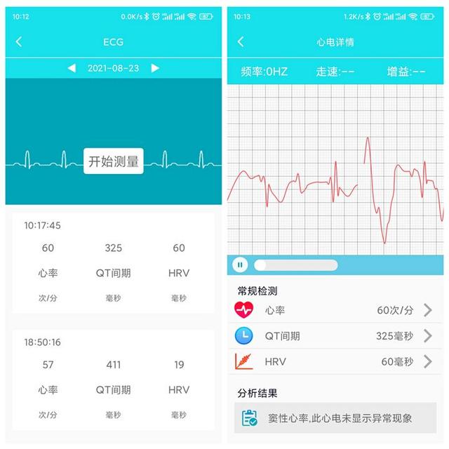 esim手表，esim智能手表排行榜前十名小米