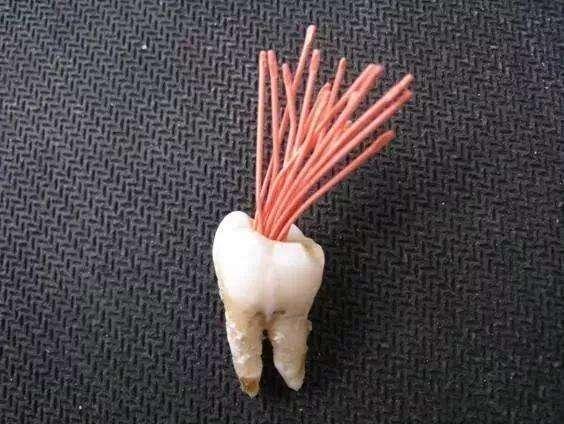 什么牙膏预防龋齿最好，牙膏怎么选？这篇推送请收好