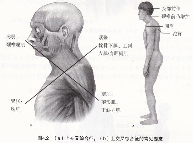 怎样练出圆肩和方肩，一天一练之肩部训练