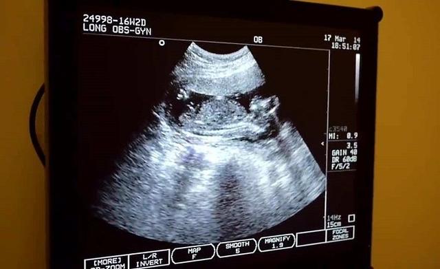 宝宝长相预测准不准，6大预测宝宝性别