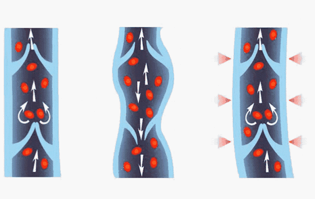 吴昕小粗腿搭配，吴昕小粗腿变女神腿