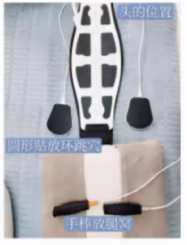 春季开背管理方法，3个管理方法很重要