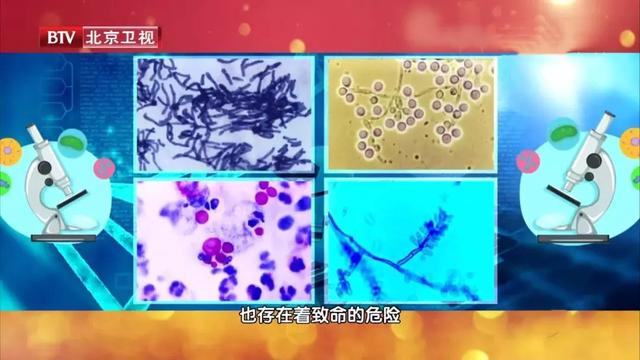 真菌糖尿病(糖尿病足 真菌感染)