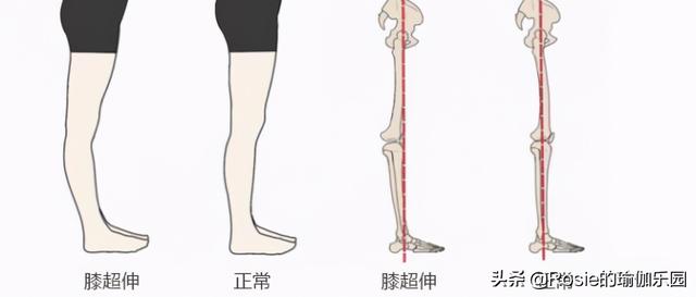李菲兒美腿比緋聞更吸睛，如何瘦出小鳥腿？超模私教2步帶你練 健身減肥達人 第14张