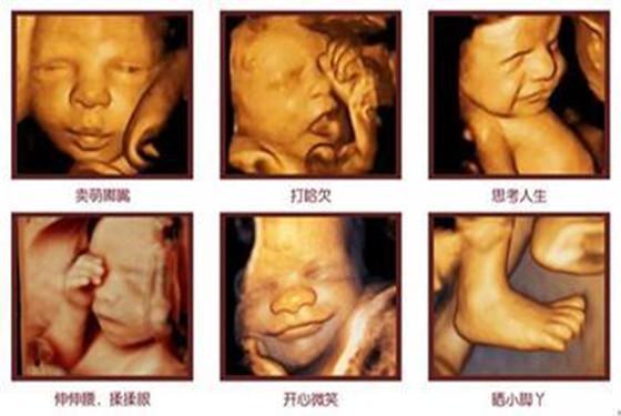 26周宝宝胎动像敲门一样，胎动是啥感觉4个月像鱼啄