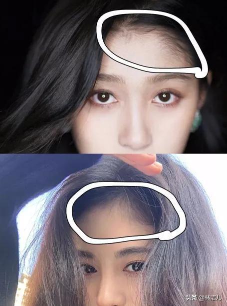 杨幂植发知乎，有种“整容”叫杨幂植发