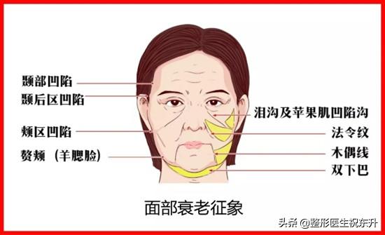 脸肥胖下垂(脸很臃肿下垂)