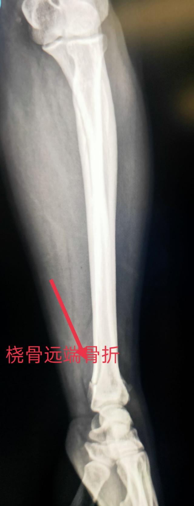 尺桡骨正侧位x线片，学习X线读片指南骨