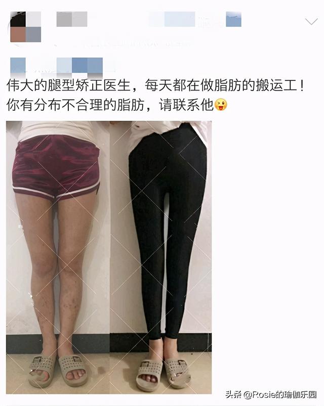 「仙劍三美」齊聚，唐嫣長腿搶鏡，超模私教帶你3步get同款美腿 健身減肥達人 第19张