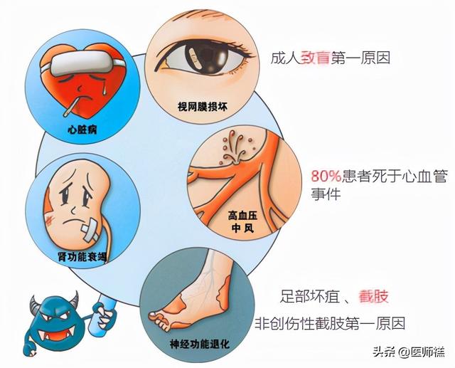 逆转ii型糖尿病(二型糖尿病逆转真正策略特点)