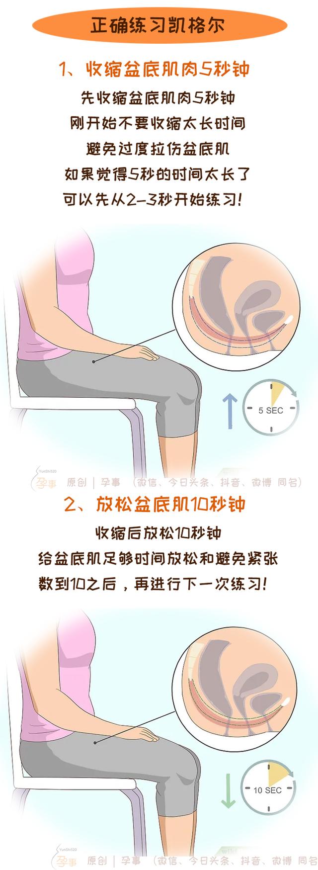 凯格尔运动方法，凯格尔运动，你做对了吗