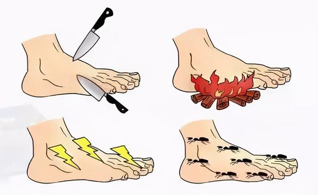 糖尿病足立项(糖尿病足诊治指南推荐的治疗方案内科治疗)