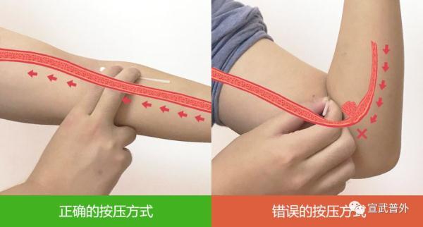 静脉采血操作流程，静脉采血操作步骤流程