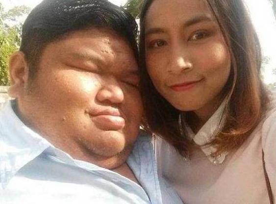 重度肥胖结婚(肥胖的婚姻)