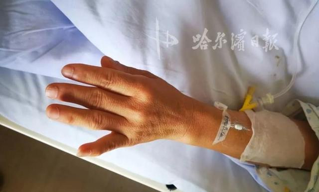 手指肥胖(手指胖是身体哪里不好)