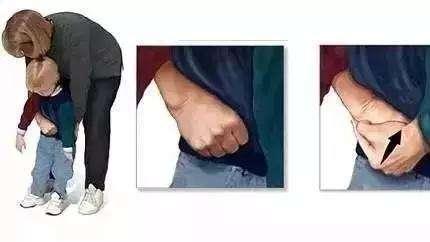 海姆立克急救法图解，4-12岁儿童海姆立克急救法图解（海姆立克急救法）