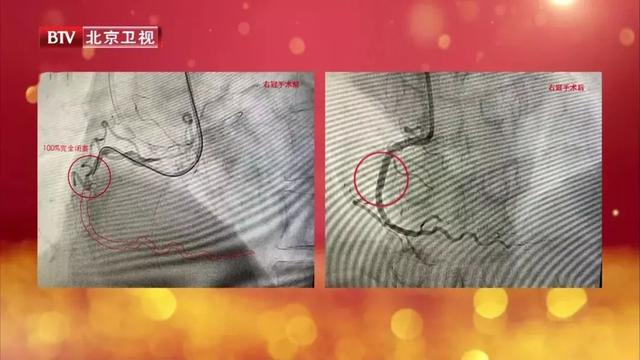小腿酸痛肥胖(小腿酸痛体重增加)