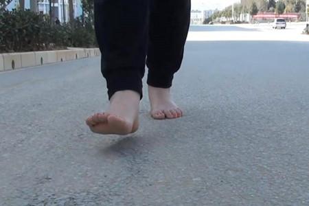 糖尿病光脚(糖尿病赤脚走路)