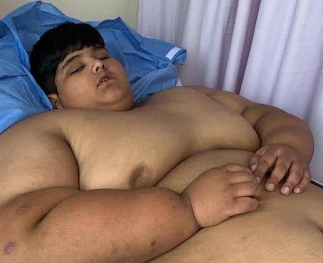 小儿肥胖男生(小男孩肥胖的危害)