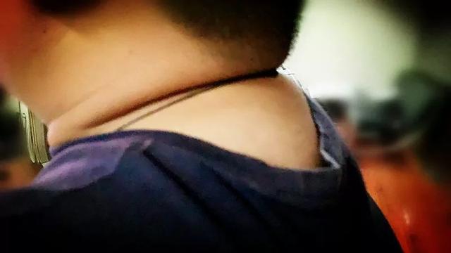 肥胖纹会长在脖子上吗(肥胖纹长的时候会痒吗)