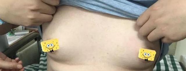 肥胖乳房增大(胖的人乳腺会增大吗)
