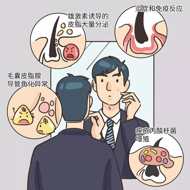 怎么判断一个男生少年感，才能充满少年感