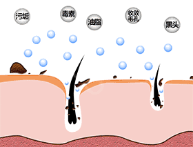 去黑头的最温和科学方法，10年老黑头都能干净