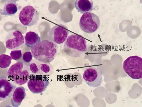 细胞周期分析是查什么，细胞周期的检测方法