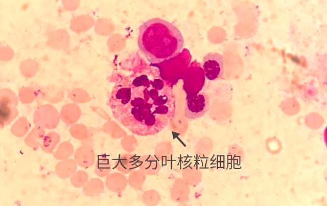 细胞周期分析是查什么，细胞周期的检测方法