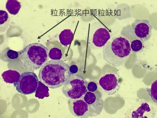 细胞周期分析是查什么，细胞周期的检测方法