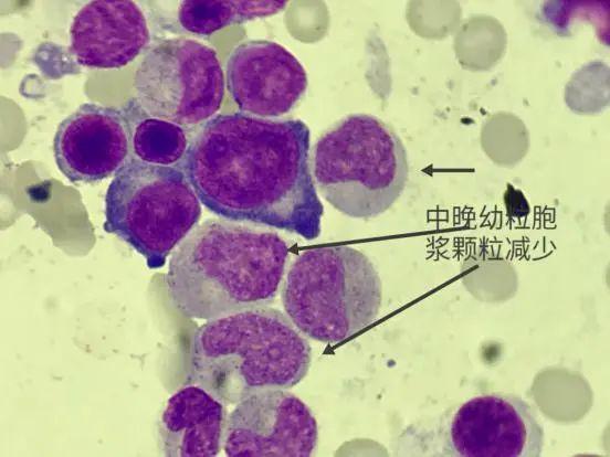 细胞周期分析是查什么，细胞周期的检测方法