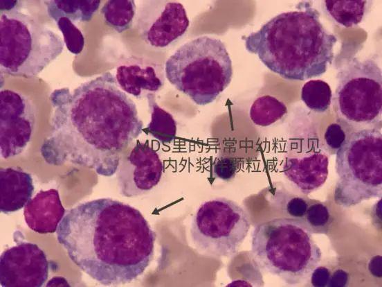 细胞周期分析是查什么，细胞周期的检测方法