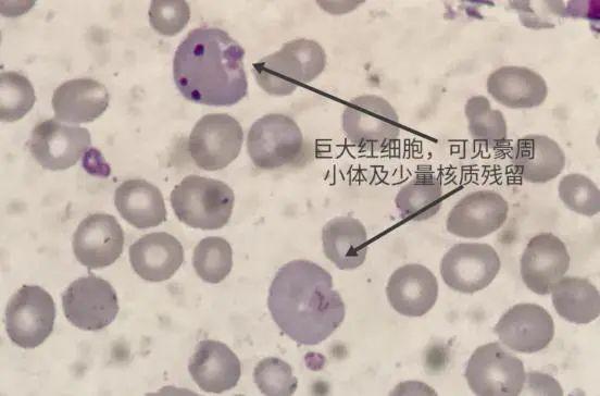 细胞周期分析是查什么，细胞周期的检测方法