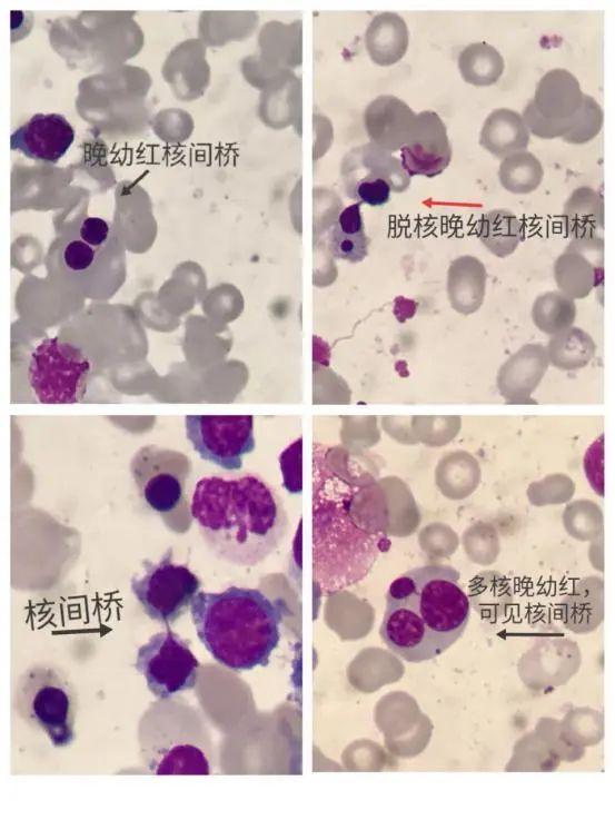 细胞周期分析是查什么，细胞周期的检测方法