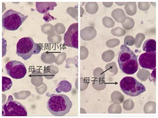 细胞周期分析是查什么，细胞周期的检测方法