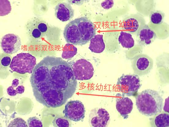 细胞周期分析是查什么，细胞周期的检测方法