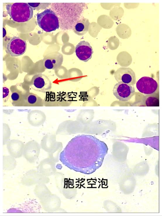 细胞周期分析是查什么，细胞周期的检测方法