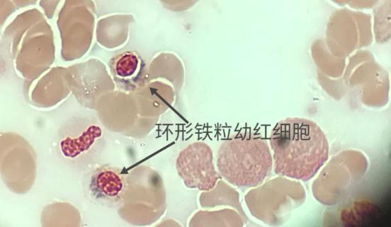 细胞周期分析是查什么，细胞周期的检测方法