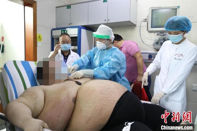 中心肥胖平躺(肥胖平躺睡觉呼吸不畅憋醒)
