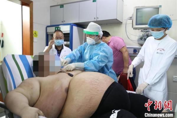 肥胖心衰(肥胖心衰为什么老想睡觉)