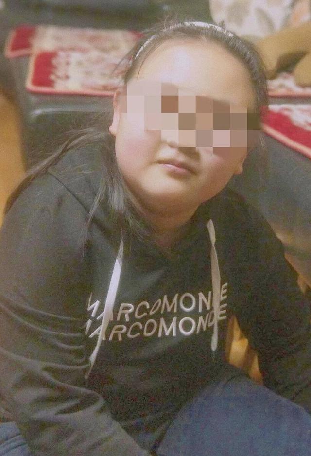个体肥胖(肥胖个体化健康教育)