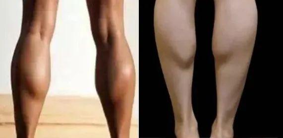 瘦小腿最有效的瘦腿贴，最全瘦身帖：筷子腿再也不是梦