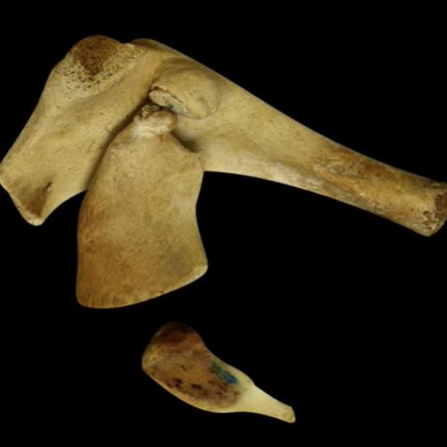 成年鲸鱼有没有天敌，鲸鱼不仅有过腿