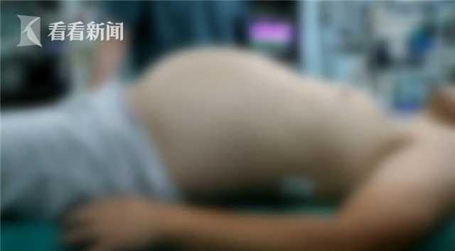 肥胖后有硬块(肥胖后有硬块怎么回事)