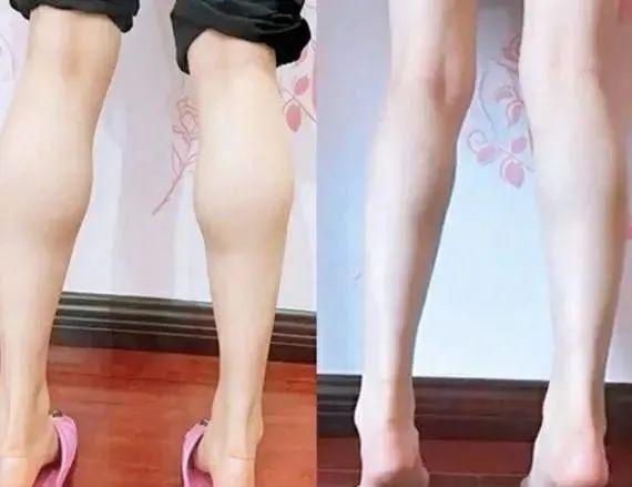 瘦小腿最有效的瘦腿贴，最全瘦身帖：筷子腿再也不是梦