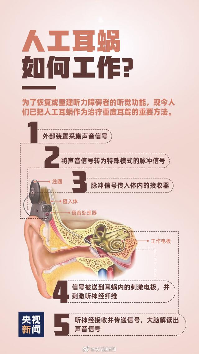 初学者怎么学会手语，一起学点简单的手语吧