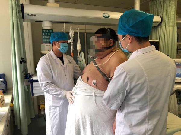 肥胖症烂了(肥胖病能活多久)
